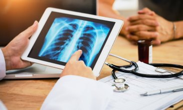 A doctor reviewing an x-ray of a pair of lungs. 