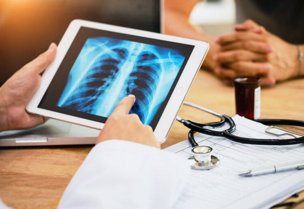 A doctor reviewing an x-ray of a pair of lungs. 