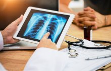 A doctor reviewing an x-ray of a pair of lungs. 